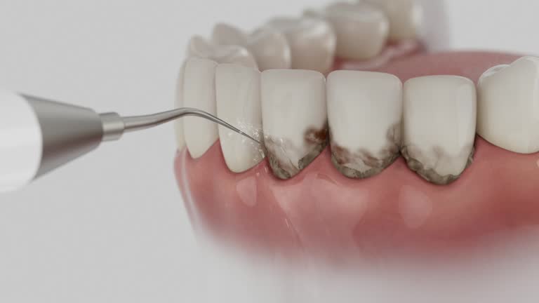 Reliable Emergency Dentist contractor in Indialantic, FL by Smile Center Dentistry